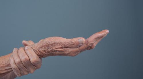 Boala Parkinson: Semne timpurii pe care nu trebuie să le ignori