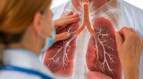 Primul semn că ai pneumonie. Mulți îl ignoră, dar este o urgență