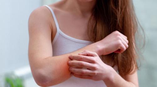 Te mănâncă pielea? Ce încearcă corpul să ți spună