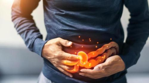 Afecțiunea digestivă comună care crește riscul de cancer de colon cu 600%