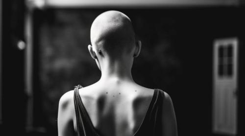 “Am aflat că am cancer la creier la o petrecere”. Semnul ciudat dat de menstruație