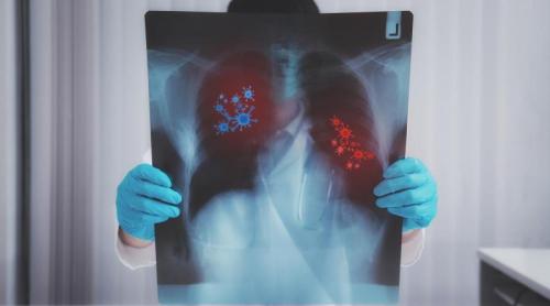 Boala legionarilor: simptomele bolii care se ascunde în aerul condiționat sau apă