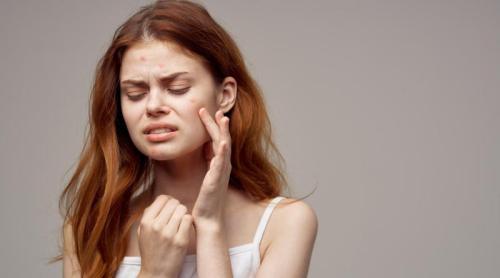 Furuncul sau carbuncul: cauze și simptome. De ce apare și cum se tratează corect