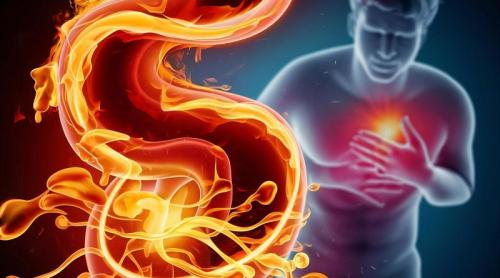 Cum scăpăm de arsurile la stomac. Prof. dr. Gabriel Constantinescu (SANADOR): Există o problemă