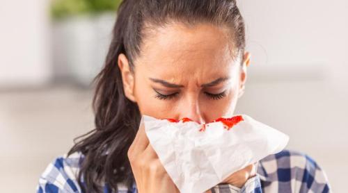 De ce îți curge sânge din nas? Epistaxis (sângerare nazală): de ce apare și când devine urgență