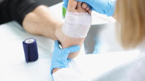 De ce nu se vindecă rănile diabeticilor