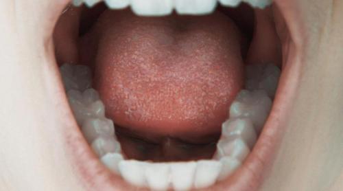 Semnalele de alarmă din gură care pot indica riscul de cancer de colon