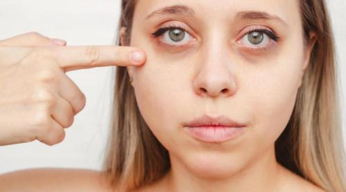 Trucul simplu care "șterge" pungile de sub ochi în câteva minute