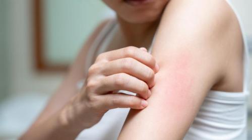 Alcoolul benzilic, desemnat alergenul anului 2026. Unde se găsește și ce efecte are