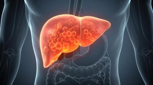 Boala de ficat care va afecta 1,8 miliarde de oameni până în 2050