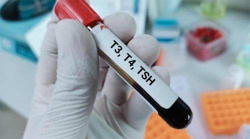 Ce înseamnă valorile TSH, care este intervalul normal și ce simptome apar când nivelul este prea mare sau prea mic