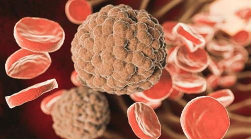 Ce trebuie să știi dacă ai trigliceridele mărite. Dr. Eva Deak: Bombă cu ceas!