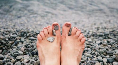 Cum să scapi corect de calusurile de pe picioare. Ce spun medicii