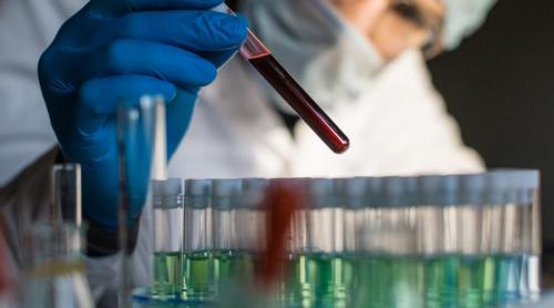 Testul de sânge banal care prezice riscul de Alzheimer cu ani înainte de simptome