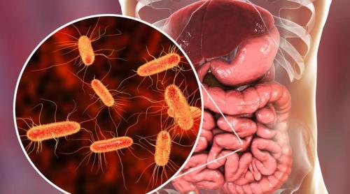 Virusul care crește riscul de cancer colorectal