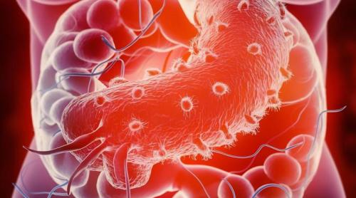 Bacteria din stomac care se transmite în familie. Ce simptome dă Helicobacter Pylori și cum o elimini