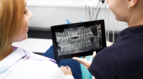 De ce antibioticele nu dau rezultate în cazul infecțiilor asociate implanturilor dentare