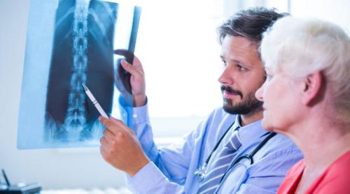 Osteoporoza, tratată mai eficient? Descoperirea care ar putea reduce riscul de fracturi