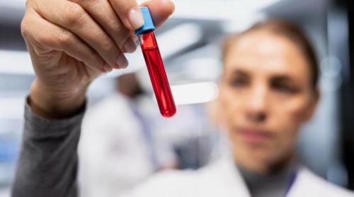 Un simplu test din sânge îți spune cât vei trăi. Ce s a descoperit despre noul "ceas biologic"