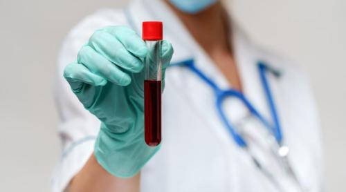 10 analize esențiale pe care să le faci anual, recomandate de dr. Mihail Pautov