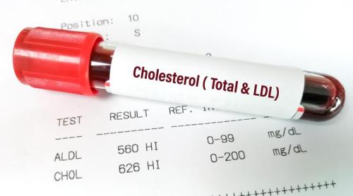 Ghidul dislipidemiei 2026: Noile ținte de LDL colesterol pentru prevenirea riscului cardiovascular