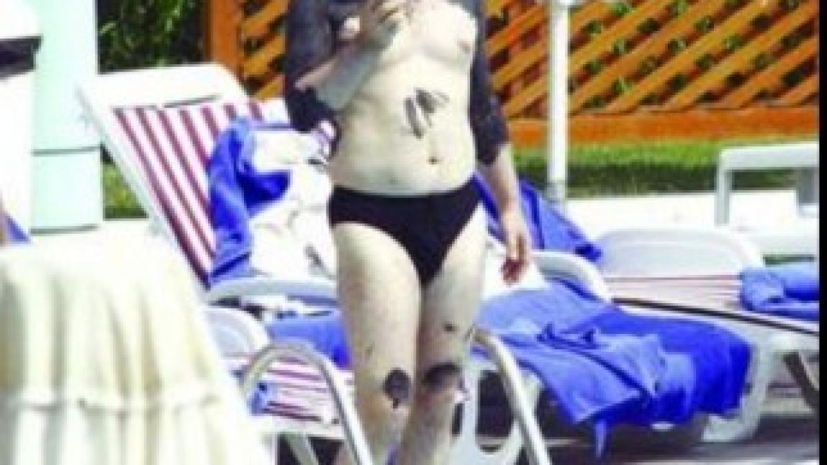 becali-cu-namol-pe-el