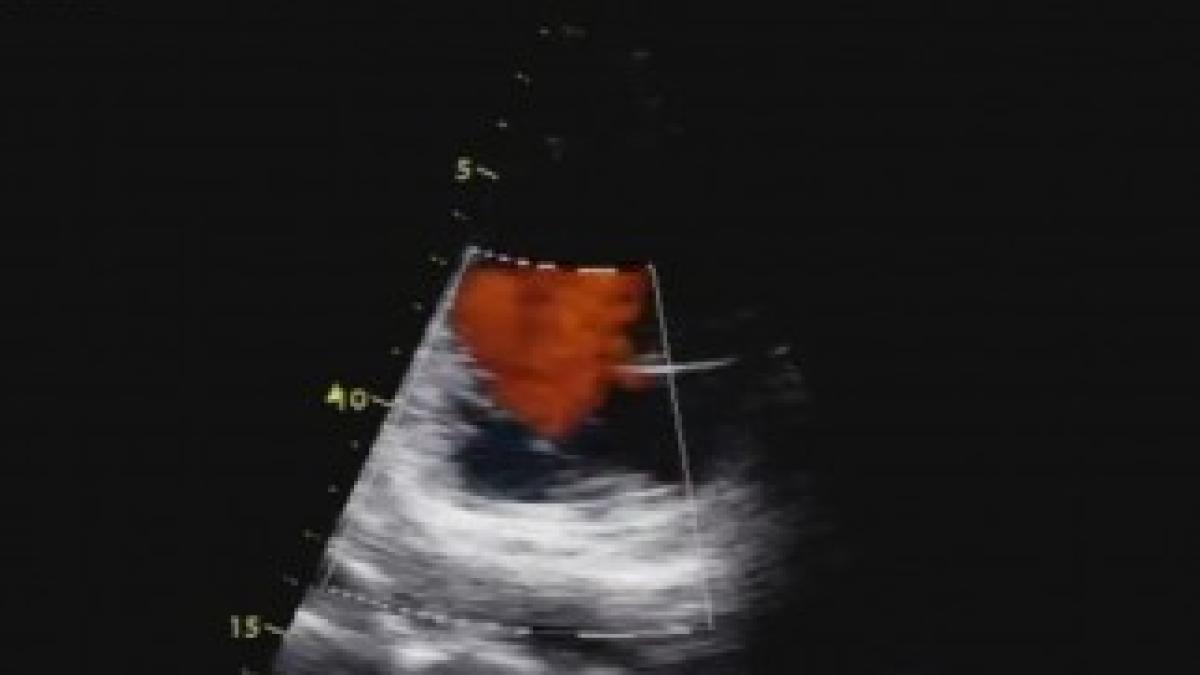 inima-e1312294261563