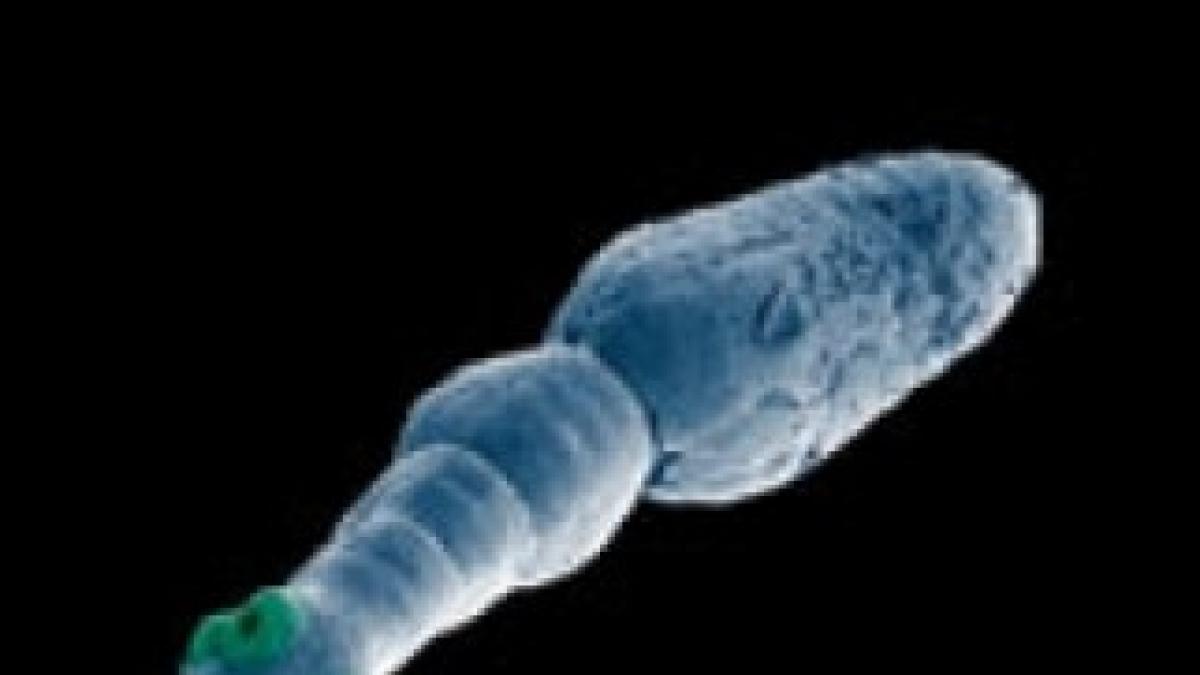 thumb_374_x_291_17055-tapeworm
