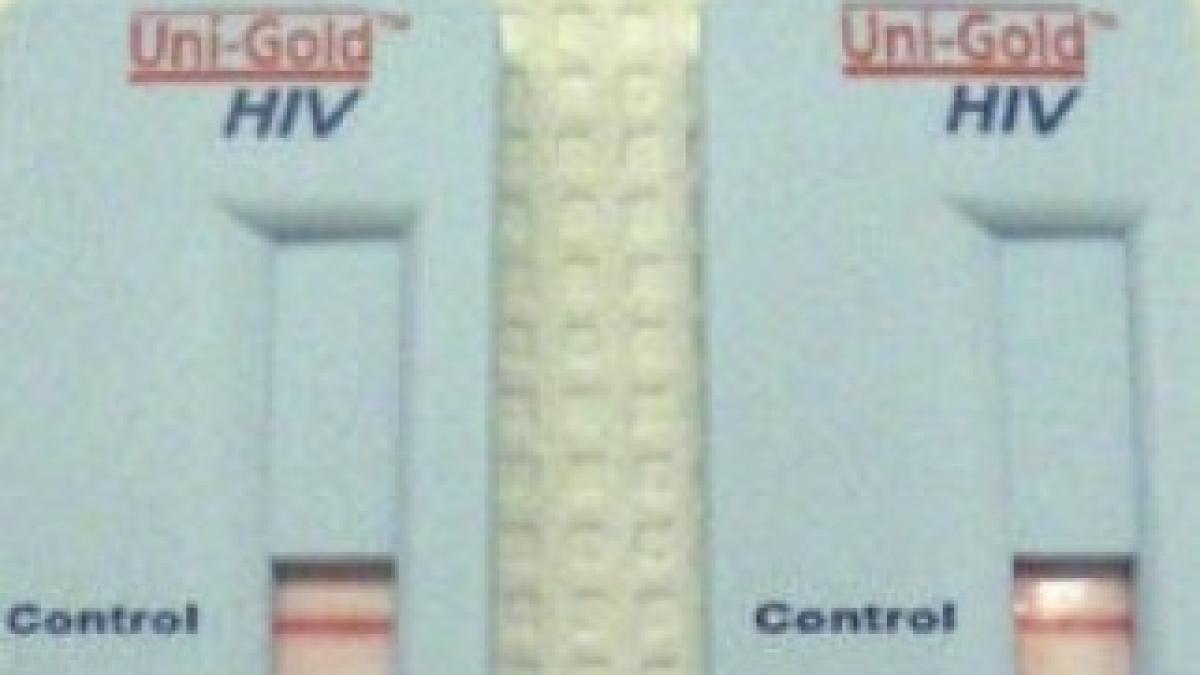 test-HIV-deschidere