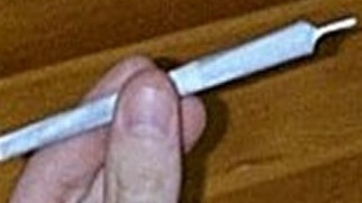 joint
