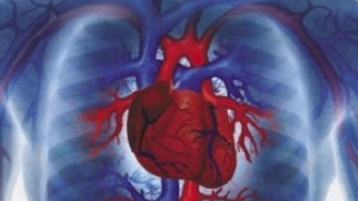 heart-disease-300x297