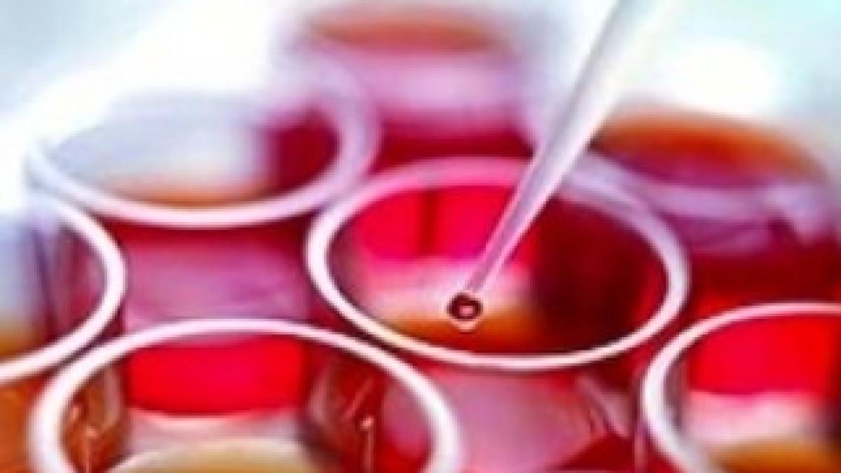 celulestem-1332921627