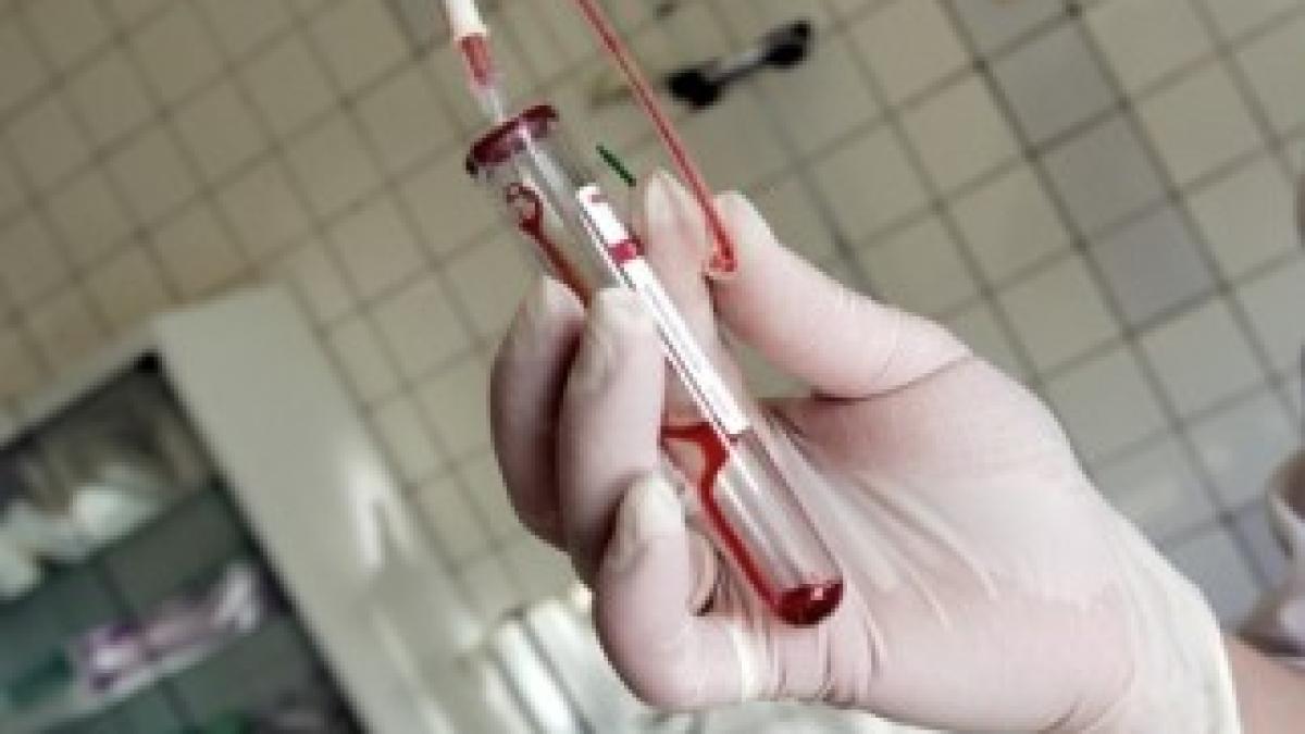 tratament-accidente-vasculare