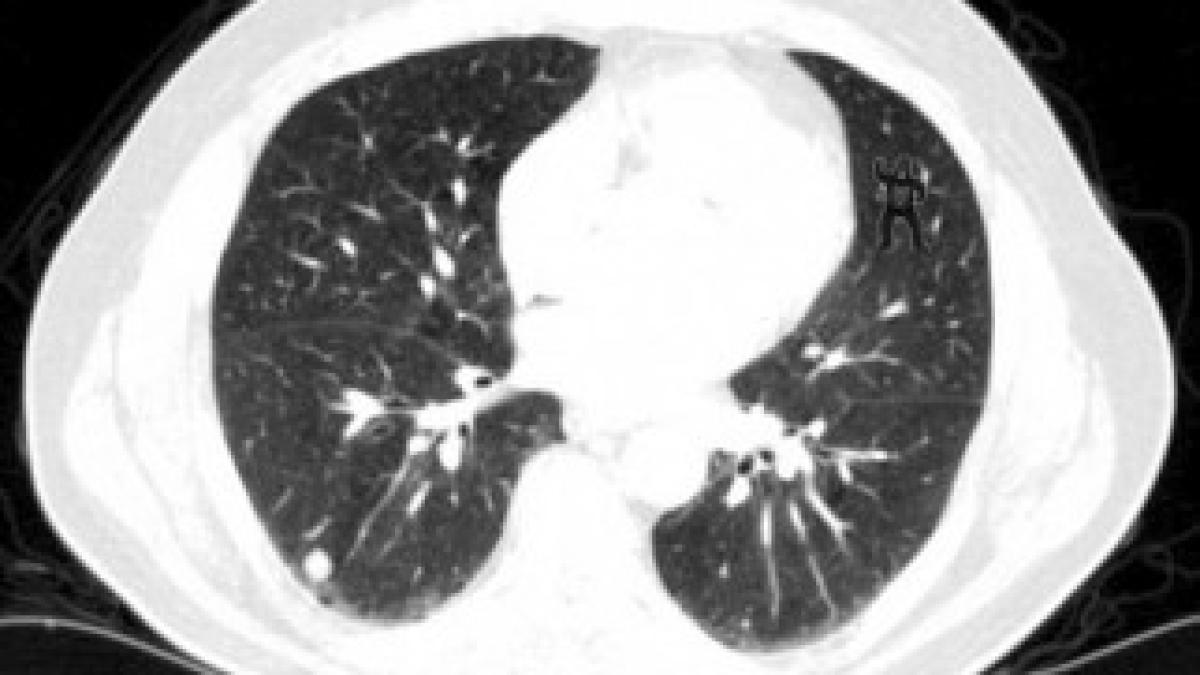 article-2277759-178A2931000005DC-720_634x476