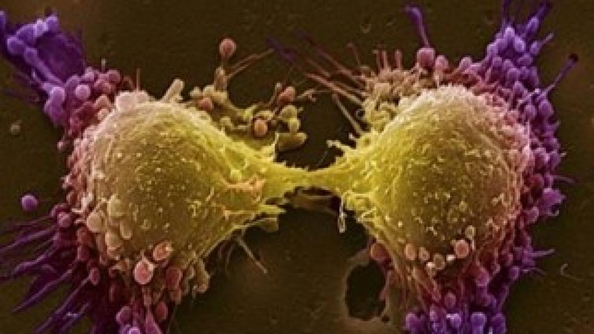 celula-canceroasa-in-diviziune