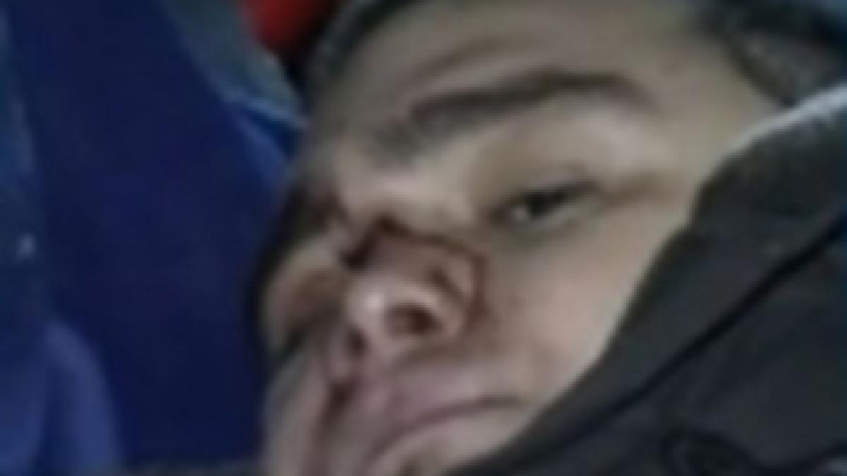 copilotul-razvan-petrescu-ranit-in-accidentul-din-apuseni-a-intrat-in-operatie-244821