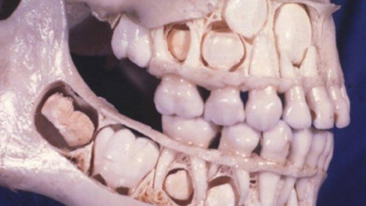 craniudinti_24811700