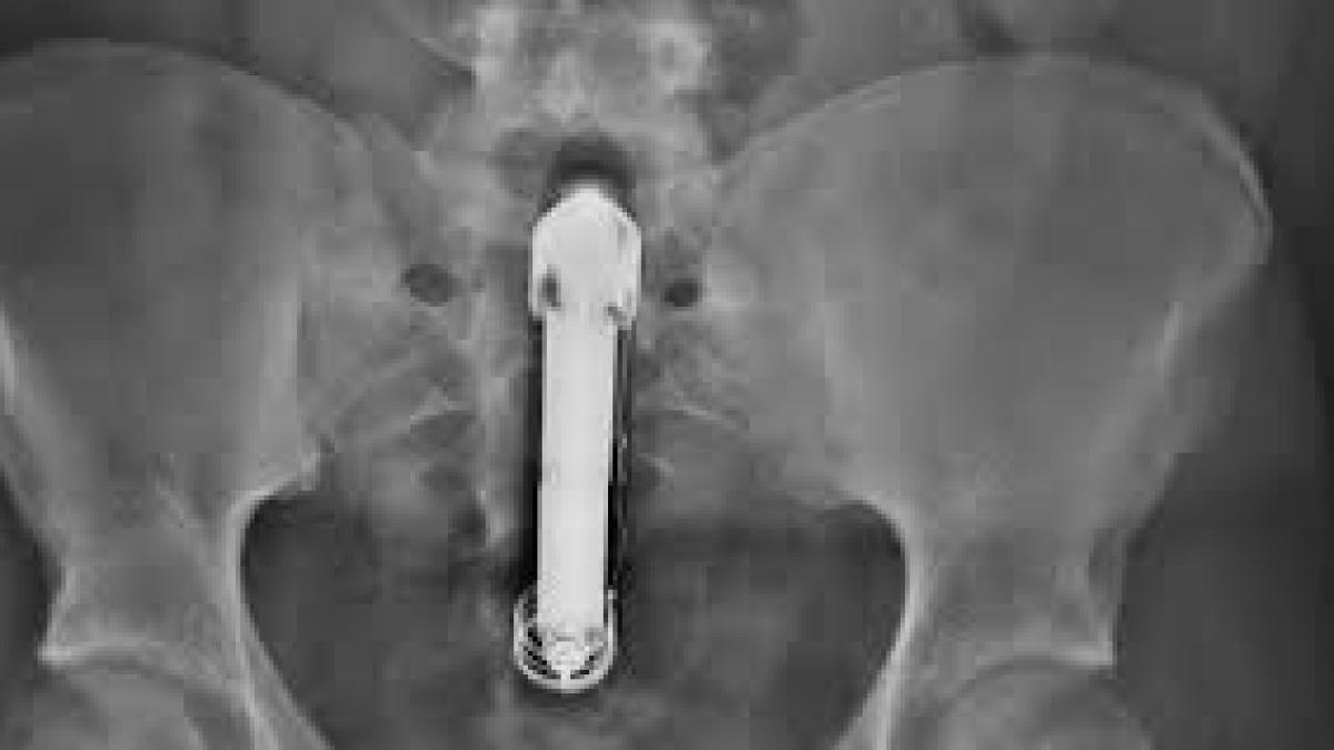 vibrator_razex_04715800