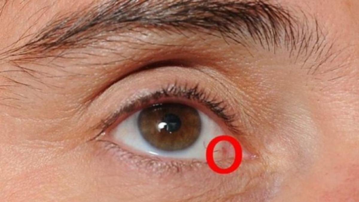 control_oftalmologic_62372400