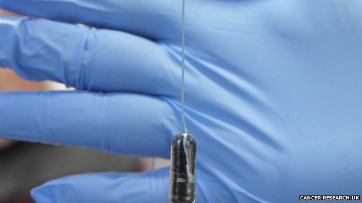 _78725435_cytospone0113_80638000