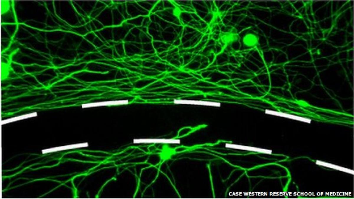 _79490617_83388_95067400