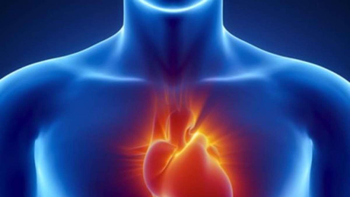 heart_attack_24892800