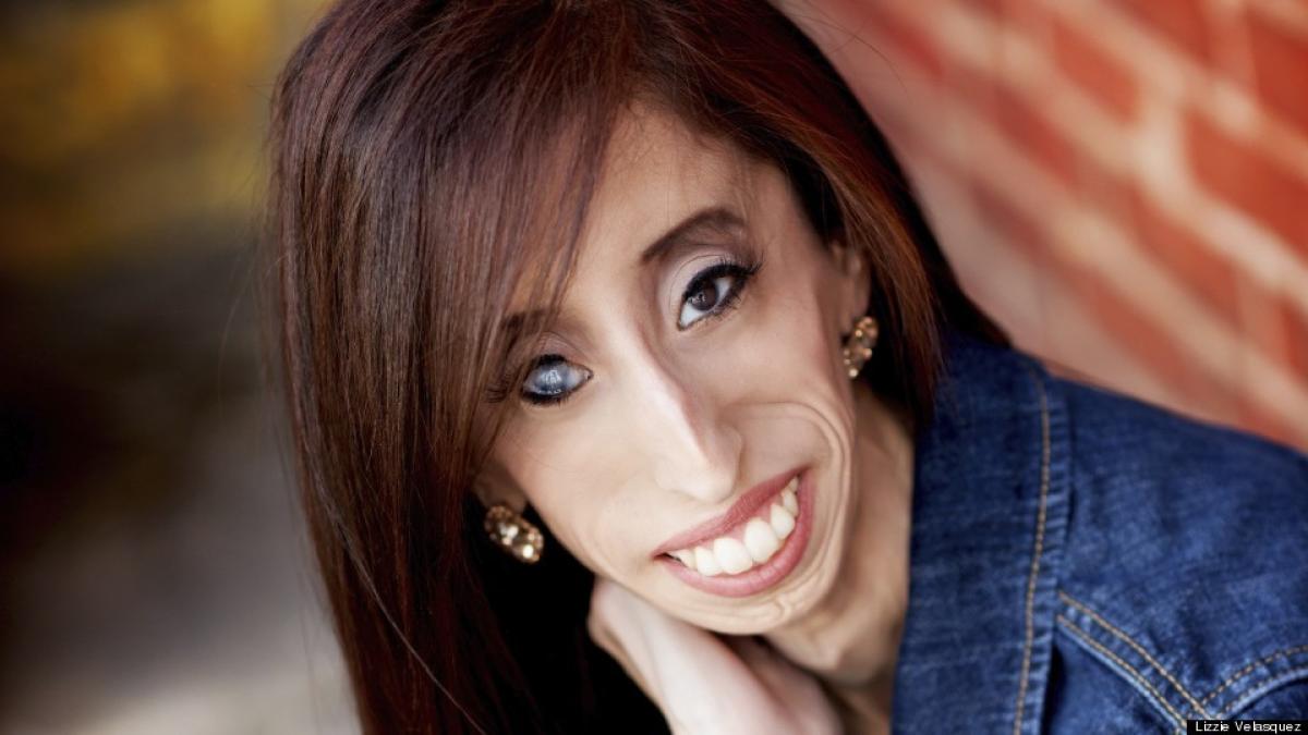 lizzie_velasquez_93495200