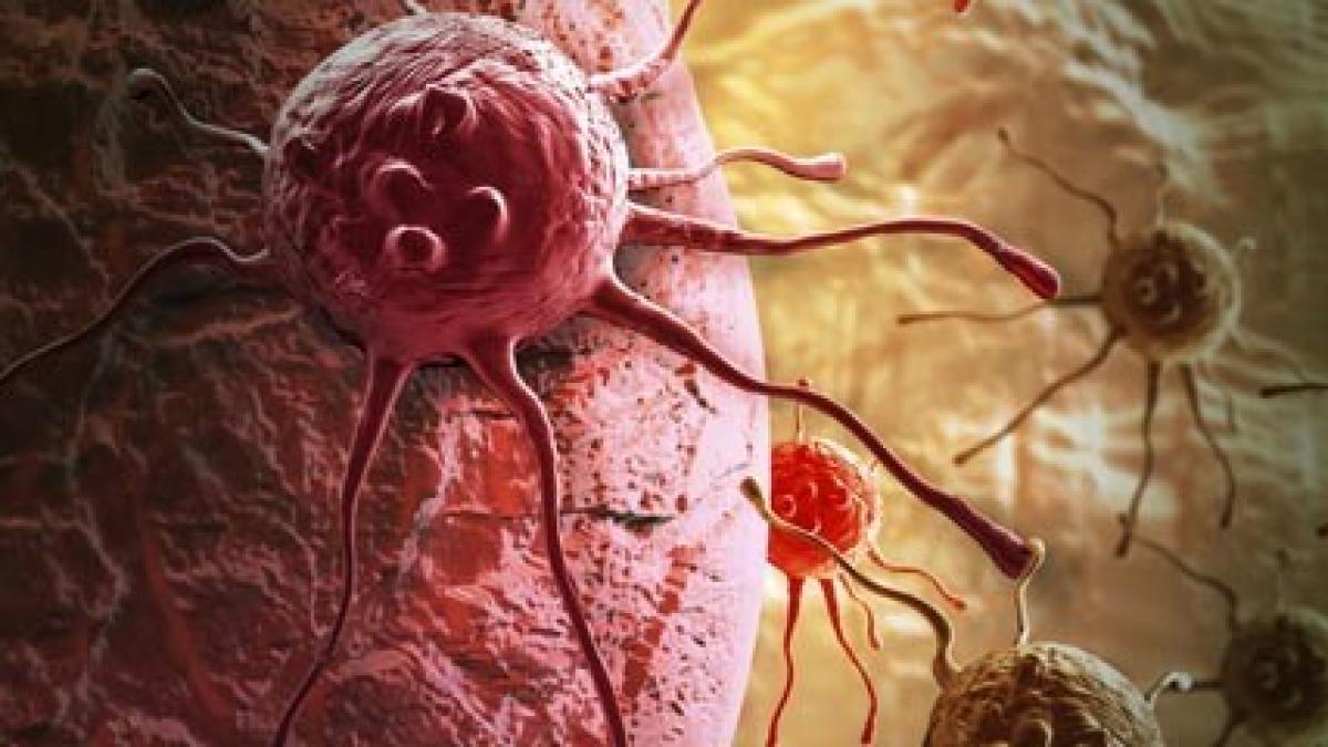 cancer_celula_22304200