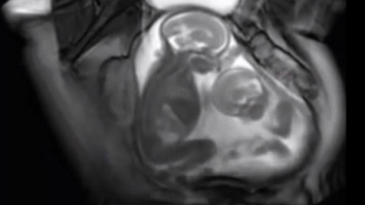 bataie_gemeni_43786100