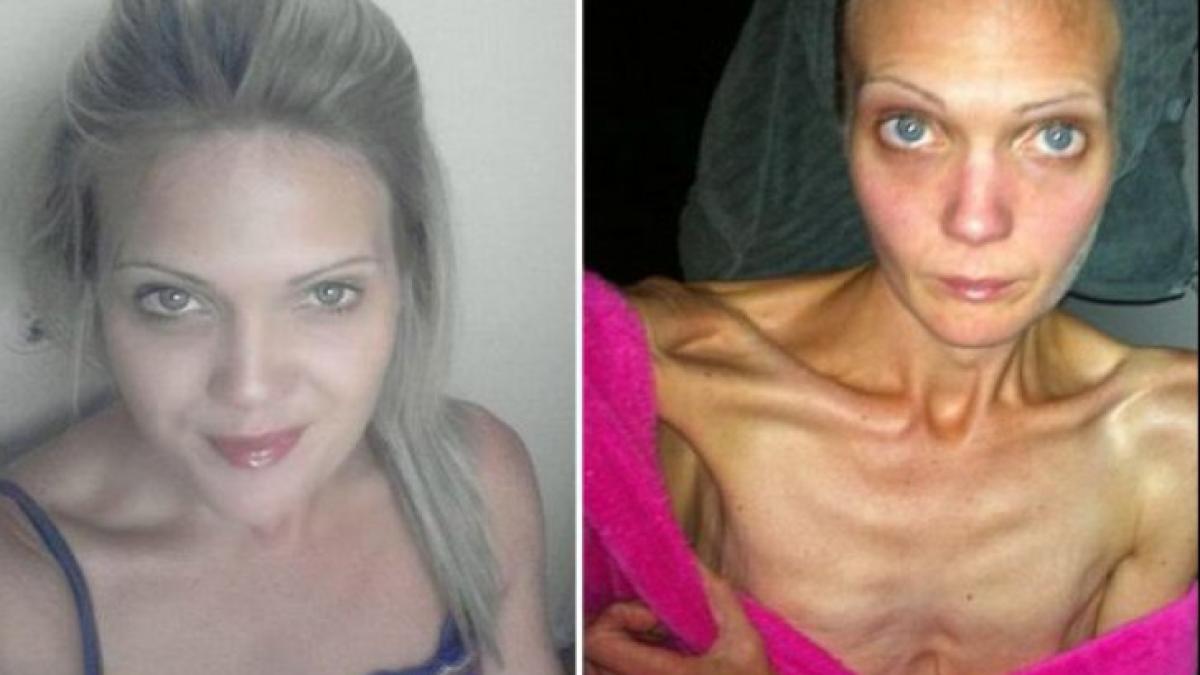 61719748_censored_98423800_04460600