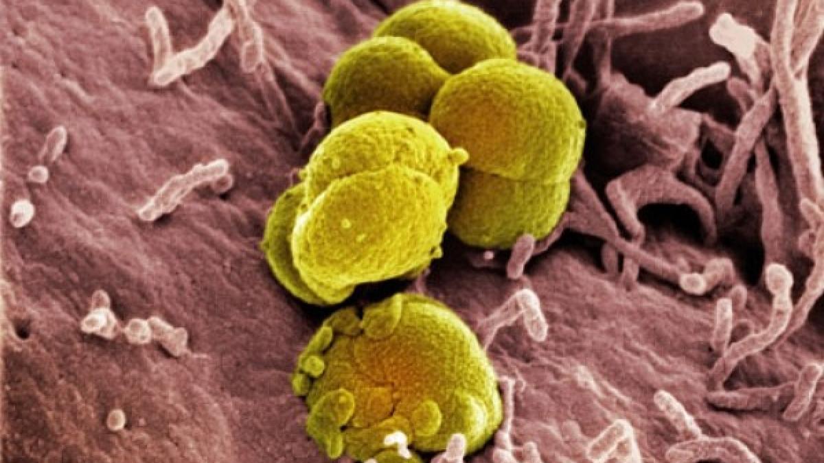bacteria_gonoreea_73988600
