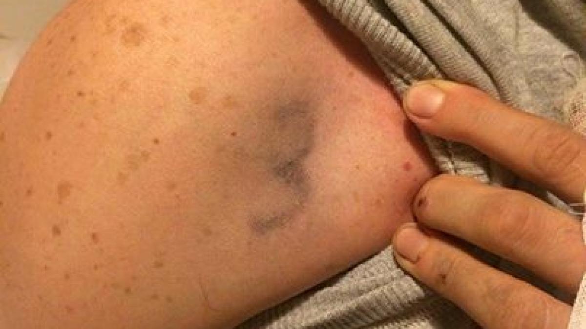 numarul_3_colectiv_56553200