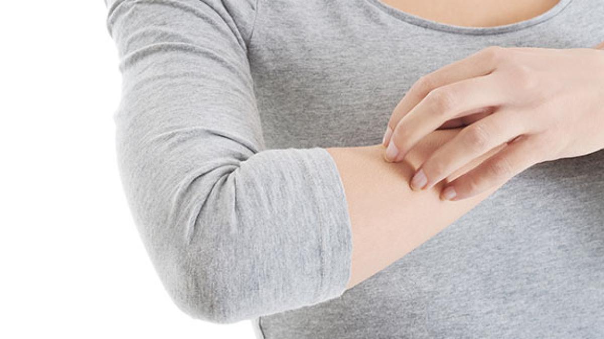 mancarimea_de_piele_57353200