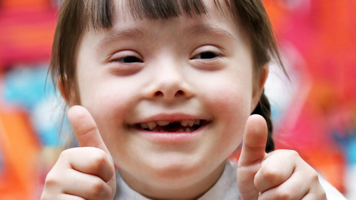 sindromul_down_84374500